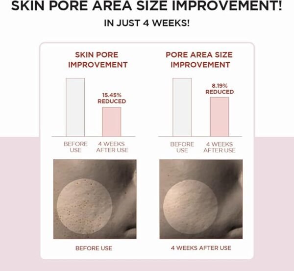 SKIN1004 Poremizing Clear Toner 210ml - Image 4