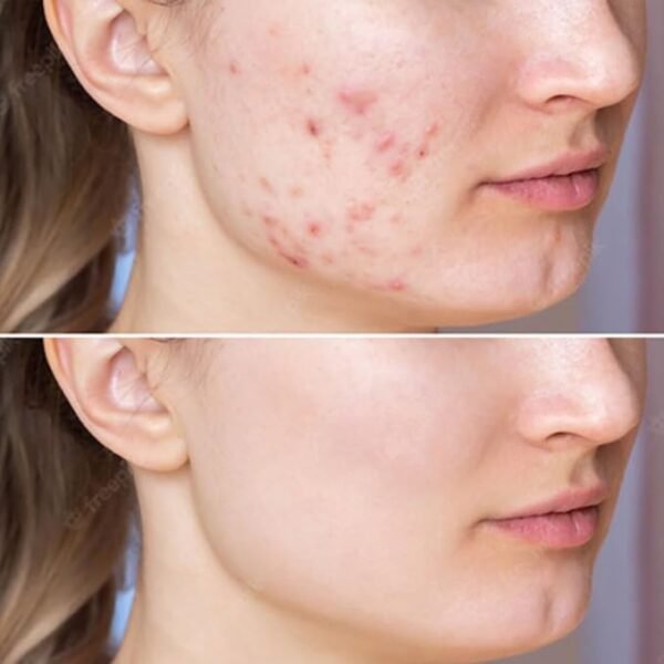 CARE:NEL Anti-Melasma Cica Treatment Toner 155ml - Image 2