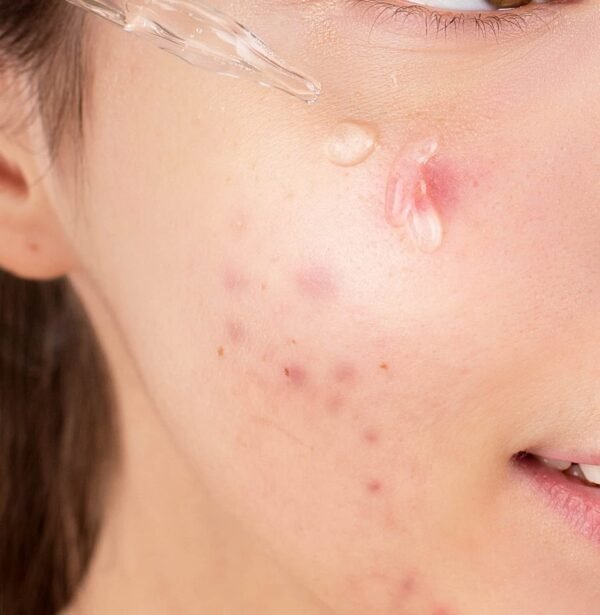 CARE:NEL Niacinamide 10% Zinc 1% Serum 30ml - Image 6