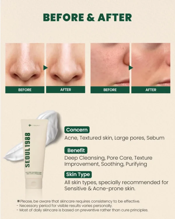 Seoul 1988 Cleansing Foam: Pine Cica 1% + Probiotics - Image 3